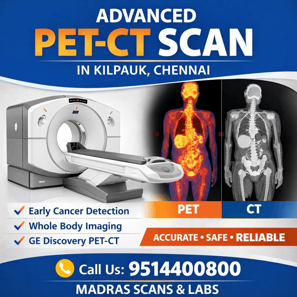 pet ct scan chennai