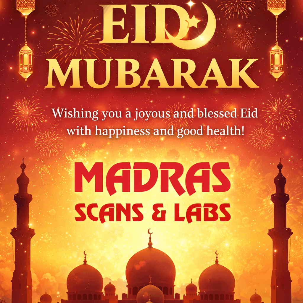 Eid Mubarak greeting with decorations